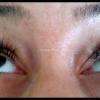 Extensions de cils
