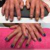 Reconstruction ongles rongés 