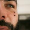 #piercingsurface #lesmarteauxpikeurspiercing #surfaceoeil #skarolmarteauxpikeurs