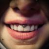 Piercing smiley, réalisé à MBA - My Body Art