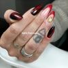 Remplissage en gel 