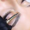 Brow lift