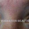 Rehaussement de cils