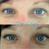 Extension de cils