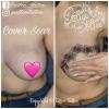 Tattoo Cover Cicatrice suite Cancer Du Sein