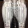 Radiographie