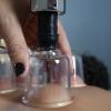 Ventouses - Cupping - Massage sportif - Libourne et Bordeaux